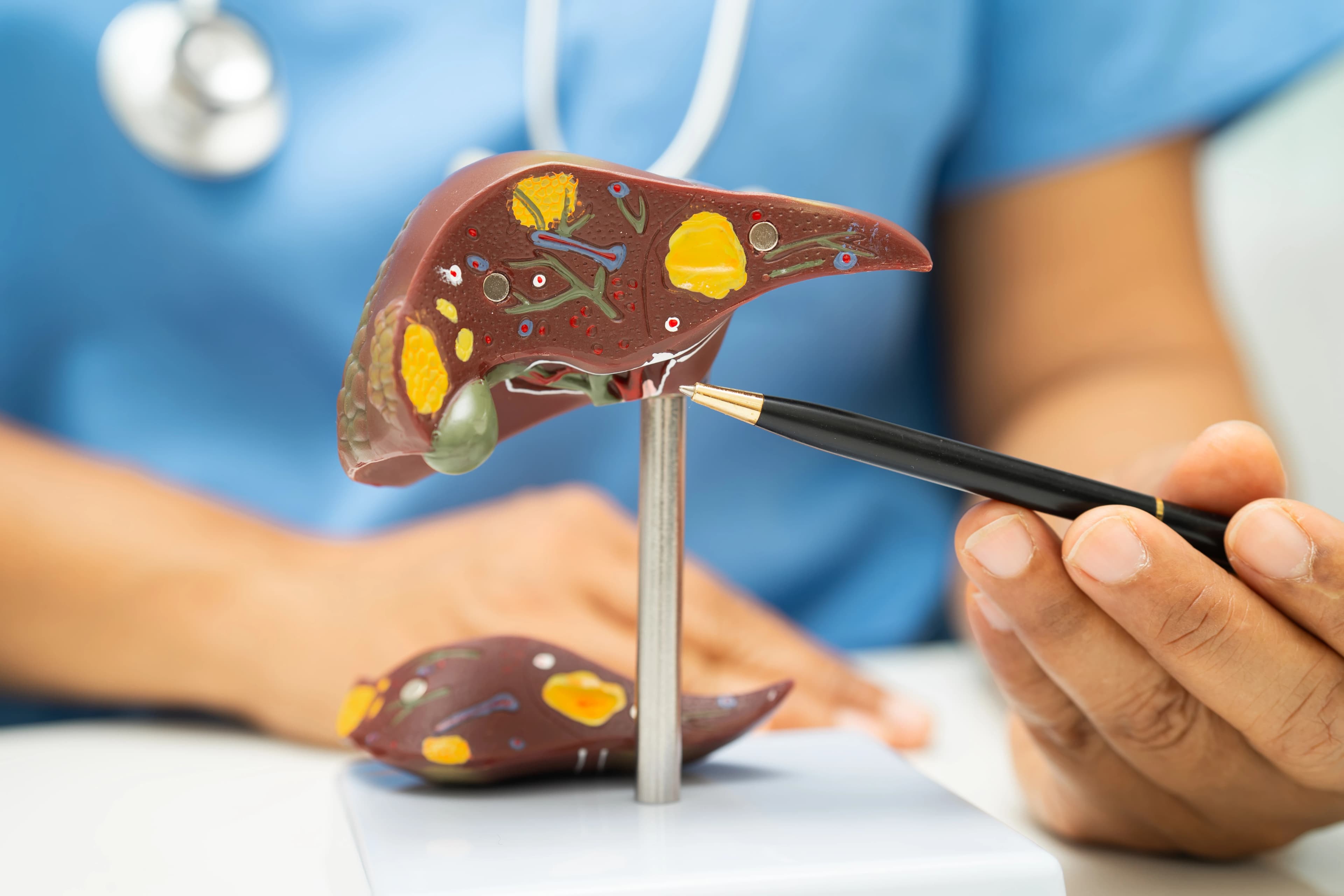 Liver Transplant